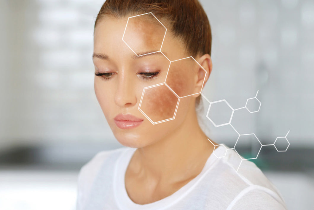 Red Light Therapy and Hyperpigmentation