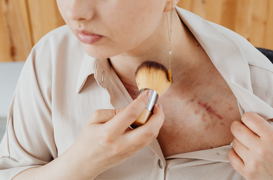 Red Light Therapy for Scar Healing