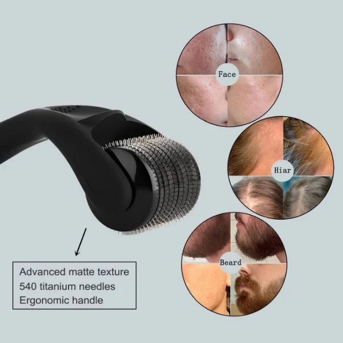 Hairo 1.5mm Dermaroller for Hair Growth